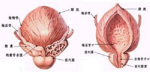 前列腺增生
