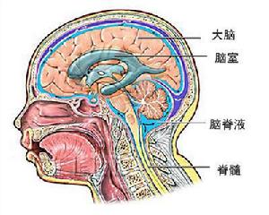 外傷性腦脊液漏