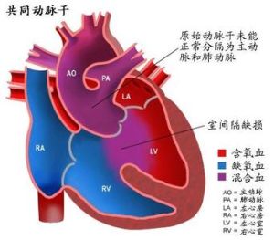 動脈乾