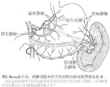 圖5 門脈高壓症