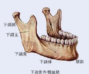 下頜角截骨