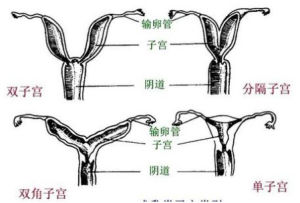 雙角子宮