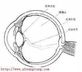 玻璃體渾濁