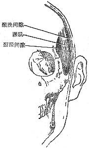 顳下間隙感染