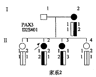 神經元蠟樣脂褐質沉積症