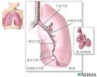 非結核性分枝桿菌病