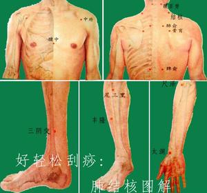 針灸刮痧穴點陣圖