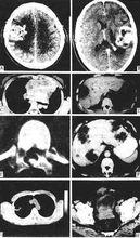 幾個部位的CT圖像