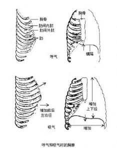 肋軟骨炎