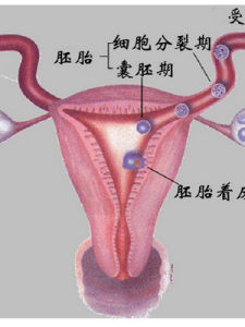 輸卵管通水