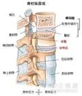 姿態性腰腿痛