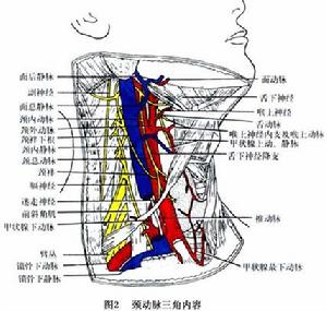 頸部血管損傷