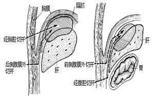 胸水