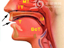 社會獲得性肺炎