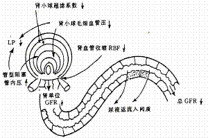 梗阻性尿路疾病