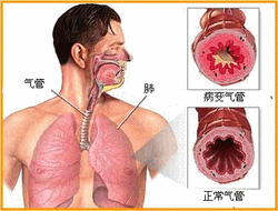 軍科免疫介入療法