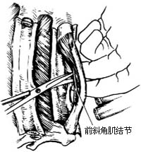 骨膜炎