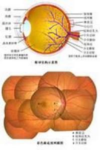 眼底病