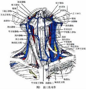 頸部血管損傷