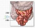 小兒急性出血性壞死性腸炎