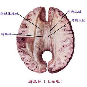 胼胝體上面觀