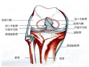 韌帶損傷