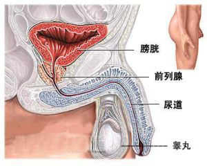 睪丸性不育