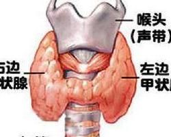 甲狀腺機能減退症