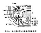 急性牙槽膿腫