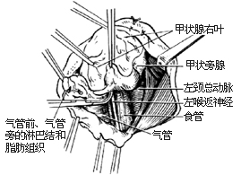 甲狀旁腺切除術