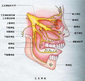 三叉神經營養性損害