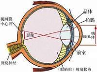 視網膜色素性變