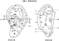 老年性聾