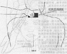 刮痧美容法