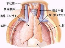 胸腺發育不全症