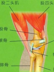 膝關節脫位