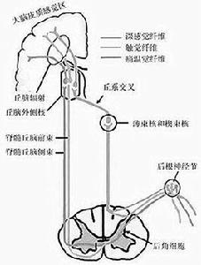 分離性感覺障礙