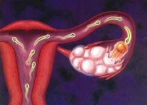 先天性卵巢發育不全症