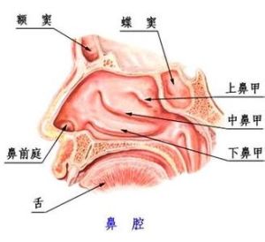 鼻息肉