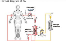 血漿吸附