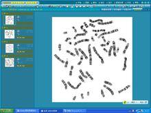 染色體圖像分析系統