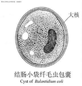 纖毛蟲病