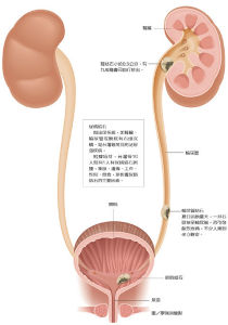 腎痛