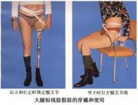 大腿短殘肢假肢