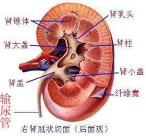 胎兒腎盂分離