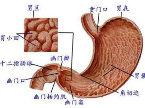 急性胃炎