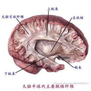 小兒硬腦膜外血腫