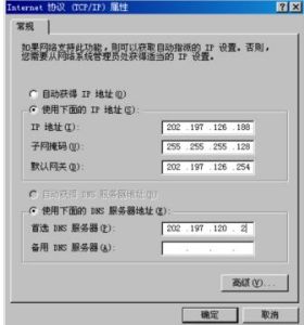 TCP/IP）屬性對話框