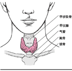 靜止性淋巴細胞性甲狀腺炎