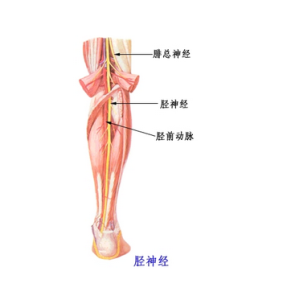 脛神經損傷